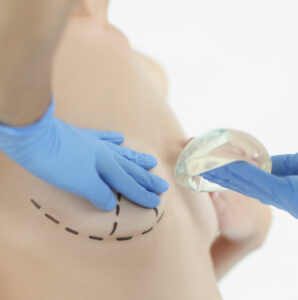 breast augmentation procedure 2
