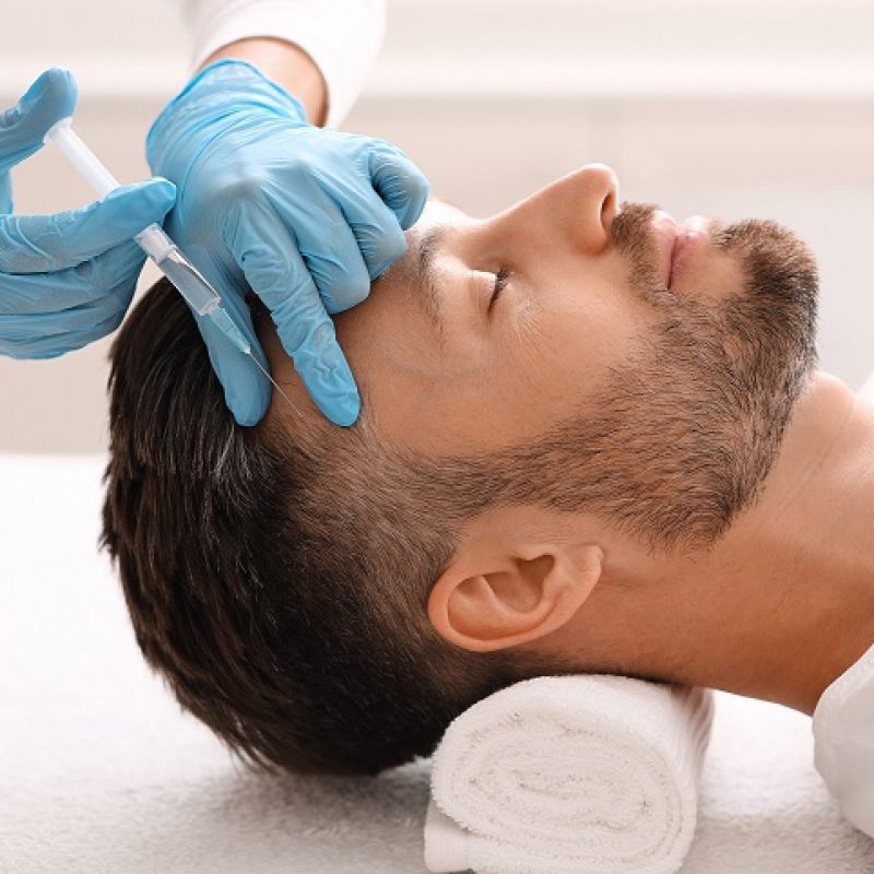 Side view of handsome middle aged man getting hair treatment at beauty salon. Man having mesotherapy session at aesthetic clinic, therapist hands in gloves making injection in scalp, closeup